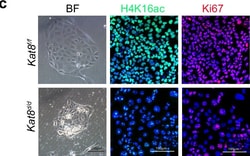 Invitrogen Donkey anti-Rabbit IgG (H+L) Highly Cross-Adsorbed Secondary