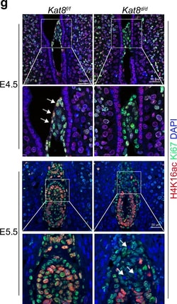 Invitrogen Donkey anti-Rabbit IgG (H+L) Highly Cross-Adsorbed Secondary