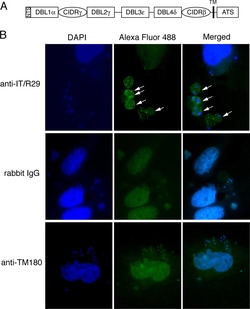 Invitrogen Goat anti-Rabbit IgG (H+L) Highly Cross-Adsorbed Secondary Antibody,