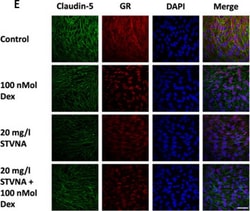 Invitrogen Donkey anti-Rabbit IgG (H+L) Highly Cross-Adsorbed Secondary