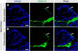 Invitrogen Goat anti-Rabbit IgG (H+L) Highly Cross-Adsorbed Secondary Antibody,
