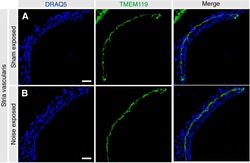 Invitrogen Goat anti-Rabbit IgG (H+L) Highly Cross-Adsorbed Secondary Antibody,