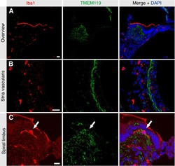Invitrogen Goat anti-Rabbit IgG (H+L) Highly Cross-Adsorbed Secondary Antibody,