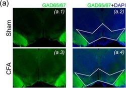 Invitrogen Goat anti-Rabbit IgG (H+L) Highly Cross-Adsorbed Secondary Antibody,