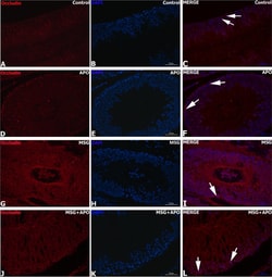 Invitrogen Goat anti-Rabbit IgG (H+L) Secondary Antibody, Biotin 2 mL;