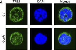 Invitrogen Goat anti-Rabbit IgG (H+L) Cross-Adsorbed Secondary Antibody,
