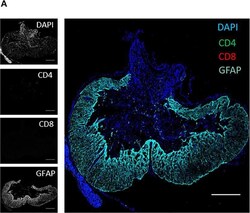 Invitrogen Goat anti-Chicken IgY (H+L) Secondary Antibody, Alexa Fluor