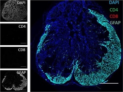 Invitrogen Goat anti-Chicken IgY (H+L) Secondary Antibody, Alexa Fluor