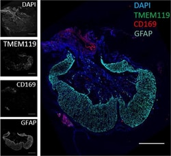 Invitrogen Goat anti-Chicken IgY (H+L) Secondary Antibody, Alexa Fluor
