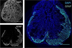 Invitrogen Goat anti-Chicken IgY (H+L) Secondary Antibody, Alexa Fluor