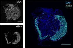 Invitrogen Goat anti-Chicken IgY (H+L) Secondary Antibody, Alexa Fluor