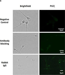 Invitrogen F(ab')2-Goat anti-Rabbit IgG (H+L) Cross-Adsorbed Secondary