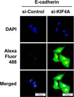 Invitrogen Donkey anti-Rabbit IgG (H+L) Highly Cross-Adsorbed Secondary