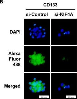 Invitrogen Donkey anti-Rabbit IgG (H+L) Highly Cross-Adsorbed Secondary