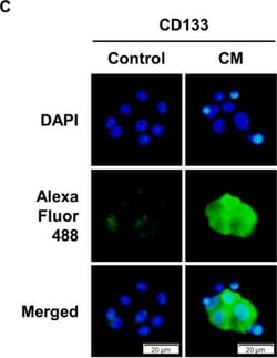 Invitrogen Donkey anti-Rabbit IgG (H+L) Highly Cross-Adsorbed Secondary