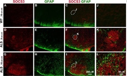 Invitrogen Donkey anti-Mouse IgG (H+L) Highly Cross-Adsorbed Secondary