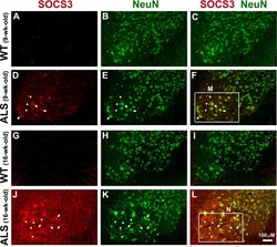 Invitrogen Donkey anti-Mouse IgG (H+L) Highly Cross-Adsorbed Secondary