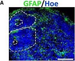 Invitrogen Donkey anti-Rabbit IgG (H+L) Highly Cross-Adsorbed Secondary