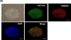 Invitrogen Donkey anti-Rabbit IgG (H+L) Highly Cross-Adsorbed Secondary