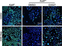 Invitrogen Donkey anti-Rabbit IgG (H+L) Highly Cross-Adsorbed Secondary