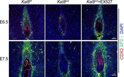 Invitrogen Donkey anti-Rabbit IgG (H+L) Highly Cross-Adsorbed Secondary