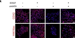Invitrogen Donkey anti-Rabbit IgG (H+L) Highly Cross-Adsorbed Secondary