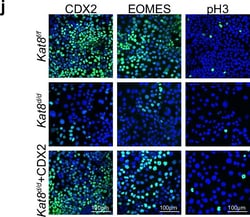 Invitrogen Donkey anti-Rabbit IgG (H+L) Highly Cross-Adsorbed Secondary