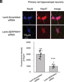 Invitrogen Goat anti-Mouse IgG (H+L) Highly Cross-Adsorbed Secondary Antibody,