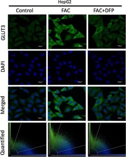 Invitrogen Goat anti-Rabbit IgG (H+L) Cross-Adsorbed Secondary Antibody,