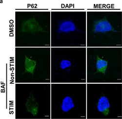 Invitrogen Goat anti-Rabbit IgG (H+L) Cross-Adsorbed Secondary Antibody,