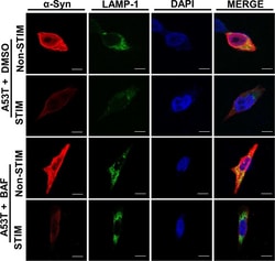 Invitrogen Goat anti-Rabbit IgG (H+L) Cross-Adsorbed Secondary Antibody,