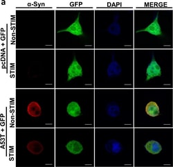 Invitrogen Donkey anti-Mouse IgG (H+L) Highly Cross-Adsorbed Secondary