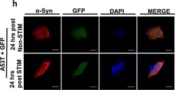 Invitrogen Donkey anti-Mouse IgG (H+L) Highly Cross-Adsorbed Secondary