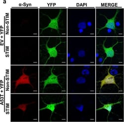 Invitrogen Donkey anti-Mouse IgG (H+L) Highly Cross-Adsorbed Secondary