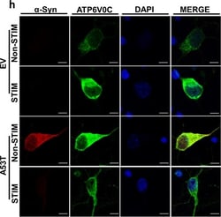 Invitrogen Donkey anti-Mouse IgG (H+L) Highly Cross-Adsorbed Secondary