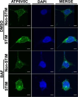 Invitrogen Goat anti-Rabbit IgG (H+L) Cross-Adsorbed Secondary Antibody,