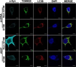 Invitrogen Goat anti-Rabbit IgG (H+L) Cross-Adsorbed Secondary Antibody,