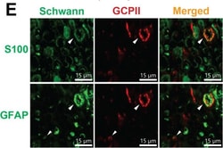 Invitrogen Goat anti-Chicken IgY (H+L) Secondary Antibody, Alexa Fluor
