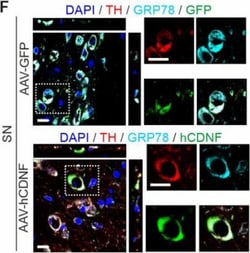 Invitrogen Donkey anti-Mouse IgG (H+L) Highly Cross-Adsorbed Secondary