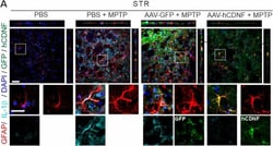 Invitrogen Donkey anti-Goat IgG (H+L) Cross-Adsorbed Secondary Antibody,