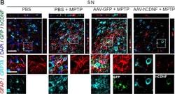 Invitrogen Donkey anti-Goat IgG (H+L) Cross-Adsorbed Secondary Antibody,