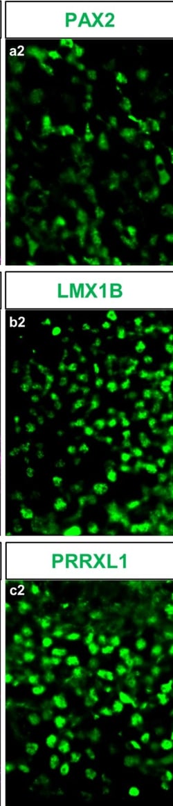 Invitrogen Donkey anti-Rabbit IgG (H+L) Highly Cross-Adsorbed Secondary
