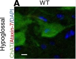 Invitrogen Donkey anti-Rabbit IgG (H+L) Highly Cross-Adsorbed Secondary
