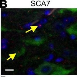 Invitrogen Donkey anti-Rabbit IgG (H+L) Highly Cross-Adsorbed Secondary