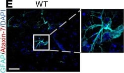 Invitrogen Donkey anti-Rabbit IgG (H+L) Highly Cross-Adsorbed Secondary