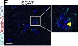 Invitrogen Donkey anti-Rabbit IgG (H+L) Highly Cross-Adsorbed Secondary