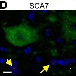 Invitrogen Donkey anti-Rabbit IgG (H+L) Highly Cross-Adsorbed Secondary