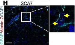 Invitrogen Donkey anti-Rabbit IgG (H+L) Highly Cross-Adsorbed Secondary
