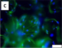 Invitrogen Donkey anti-Mouse IgG (H+L) Highly Cross-Adsorbed Secondary