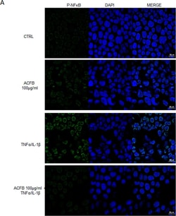Invitrogen Goat anti-Rabbit IgG (H+L) Cross-Adsorbed Secondary Antibody,